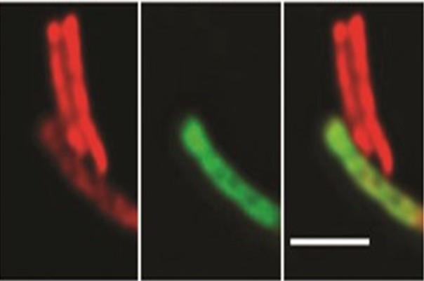 Synthetic peptides as promising tuberculosis therapeutics