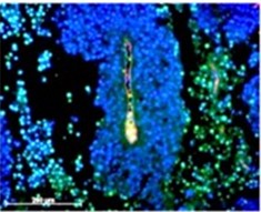 Targeting cell-surface GRP78 for cancer therapy