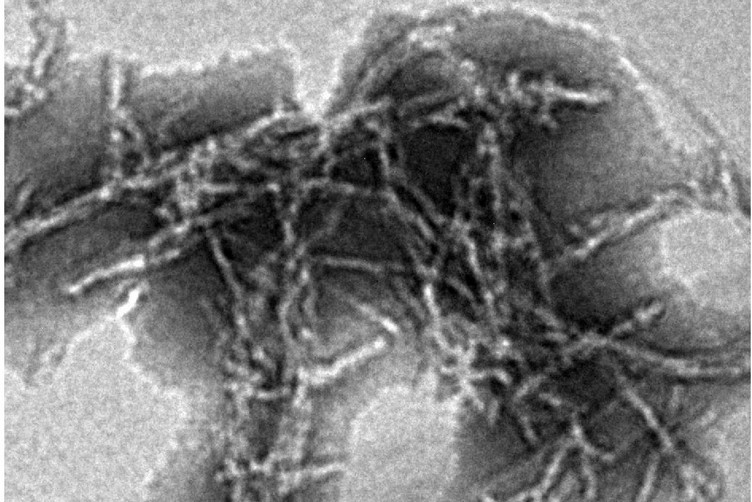 Dynamic switch for FUS proteinopathy