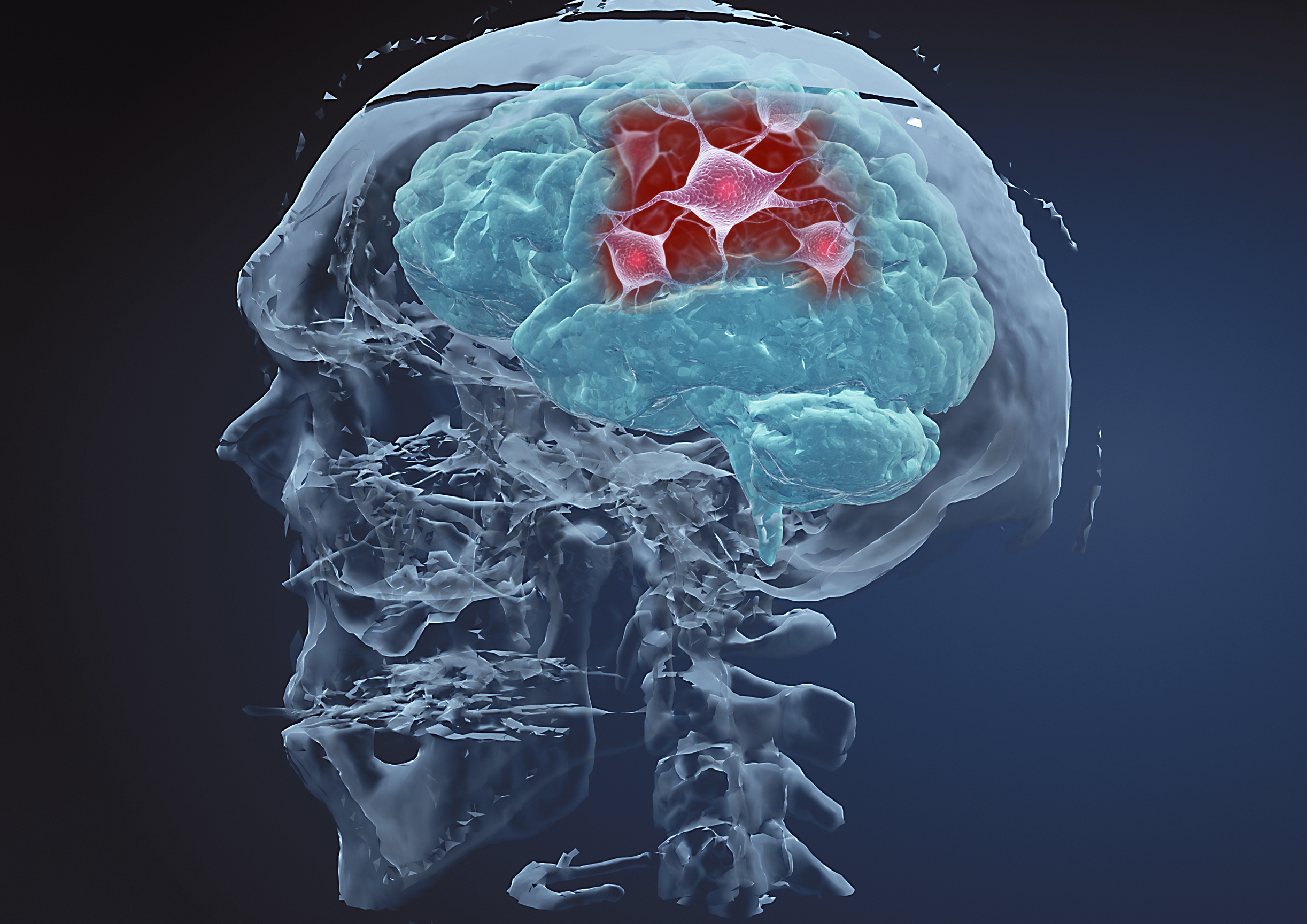 High-order secret decrypted for TDP-43 causing amyotrophic lateral sclerosis