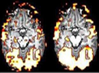 Multiple Testing via FDRL for Large Scale Imaging Data