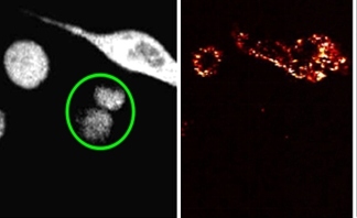 Gold nanoparticle clusters for simultaneous photo-thermal imaging and therapy