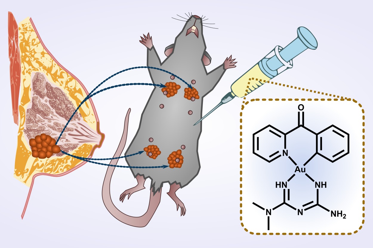 Treating aggressive breast cancer with an anti-diabetic drug