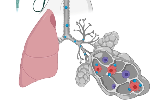 A biologic drug for the treatment of chronic obstructive pulmonary disease