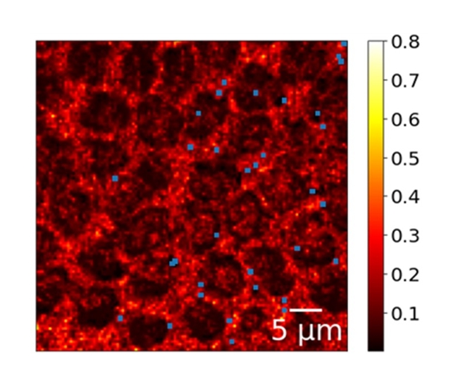 Deep learning for real-time molecular imaging